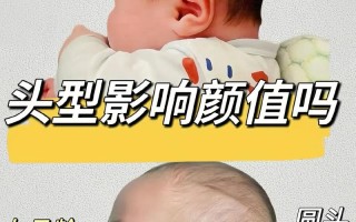 儿童扁头发型有哪些款式？不同脸型适合哪种扁头造型？