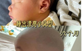 新生儿宝宝总喜欢歪头睡，是习惯使然还是隐藏健康信号？