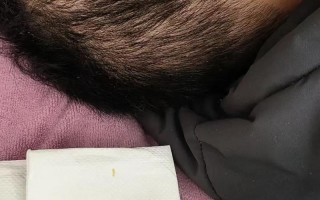 新生儿耳廓里的黏耳屎是正常现象吗？需要清理吗？