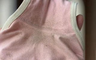 怀孕期间内裤总是湿的，是正常生理变化还是异常信号？