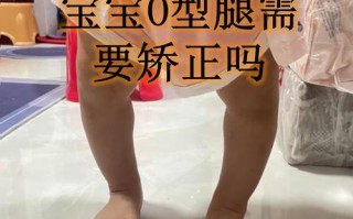 儿童腿型发育标准图片如何准确判断不同年龄段的正常与异常？