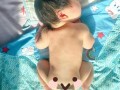 新生儿黄疸晒太阳晒哪个部位？