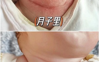 新生儿衣服总是漏脖子