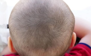 新生儿后脑勺骨头不平是缺钙还是发育异常？需要干预吗？