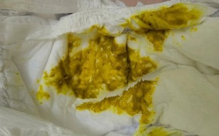 新生儿第一天没大便，是正常现象还是需要警惕的健康信号？