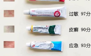 新生儿湿疹安全用药指南，哪些药能缓解，哪些药要避开？