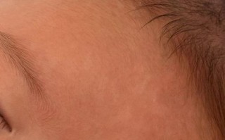 新生儿脑白质信号异常是脑损伤吗？会影响发育吗？需要怎么干预？