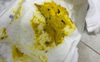 新生儿 呕吐 拉肚子