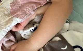 新生儿睡觉时总伸胳膊是正常现象还是身体不适的信号？