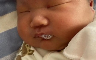 新生儿支气管肺炎重症为何凶险？家长如何应对治疗与护理？