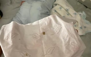 新生儿打喷嚏时鼻屎发黄是正常现象还是健康预警？