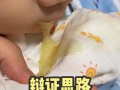 新生儿为什么一吃就吐
