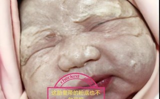 怀孕期间化妆真的会导致胎儿畸形吗？科学依据与安全指南是什么？