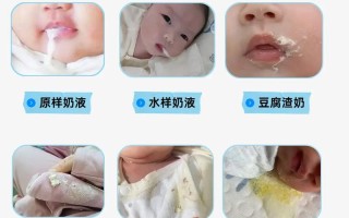 新生儿几个月停止吐奶？如何判断吐奶是否正常需就医？