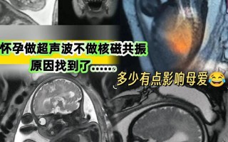 新生儿做磁共振检查费用是多少？不同地区和医院收费标准差异大吗？