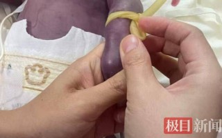 新生儿身体发紫是危险信号吗？需要立即就医的紧急情况有哪些？