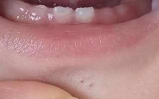 新生儿舌头白色物是何物？需处理吗？