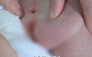 新生儿隐形脊柱裂症状有哪些？