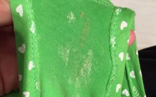 孕期白带发绿是感染信号吗？需要立即就医处理吗？