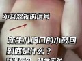 新生儿胆管细窄有哪些典型表现？家长该如何早期识别与应对？