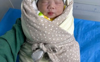 21三体综合症新生儿