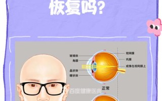 儿童近视一旦发生真的能恢复正常视力吗？