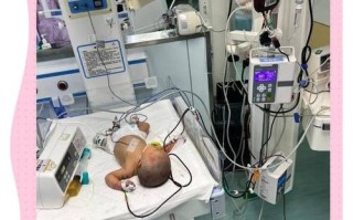 新生儿Rh溶血症换血治疗的关键难点与风险管控措施有哪些？