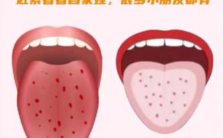 新生儿舌尖发红是怎么回事