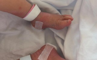 新生儿采足底血到底在出生后第几天最合适？采血时间会不会影响检测结果准确性？