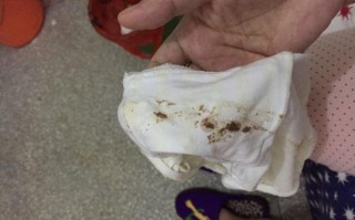 孕期吃螃蟹后出现褐色分泌物，是正常反应还是异常信号？