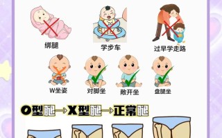 新生儿O型腿怎么判断？家长需注意哪些异常信号与矫正方法？