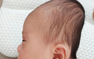 新生儿睡头型，崔玉涛怎么看？科学矫正还是自然生长？