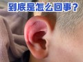 孩子耳朵流黄水是中耳炎吗？家长该如何正确处理与护理？