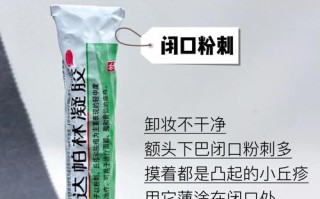 新生儿痤疮该擦什么药膏？安全有效的婴儿祛痘产品有哪些？