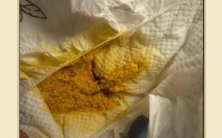 新生儿拉屎放屁时总是很用力，是正常现象还是身体不舒服？