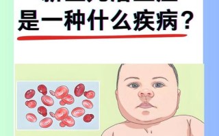 新生儿溶血有哪些早期症状？如何通过检查确诊？