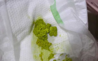 新生儿拉绿色奶瓣图片