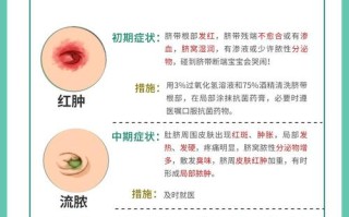 新生儿脐带发炎会有哪些异常症状？家长该如何辨别和应对？