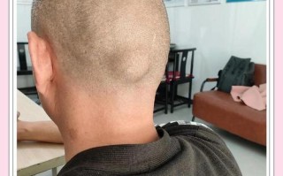 新生儿先天性大脑囊肿是什么原因导致的？会影响宝宝发育吗？