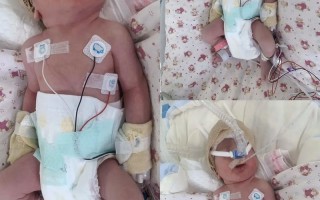 新生儿意外死亡常见原因有哪些？家长该如何有效预防这些悲剧发生？