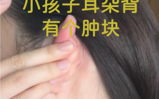 儿童耳后淋巴结肿大图，正常与异常的界限在哪里？需警惕哪些疾病信号？