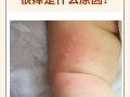 儿童全身瘙痒警惕哪些疾病？