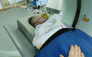 新生儿钡灌肠造影检查，这项检查安全吗？宝宝会痛苦吗？家长需要做哪些准备？