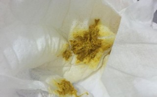 新生儿大便突然喷黄水带屎，是消化不良还是感染了？