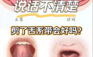 儿童说话不清楚割舌筋真能解决问题吗？