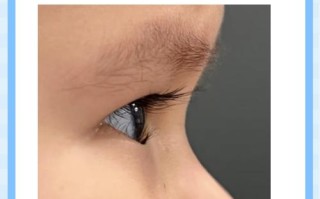 新生儿为什么没有睫毛？是发育未完全还是另有进化奥秘？