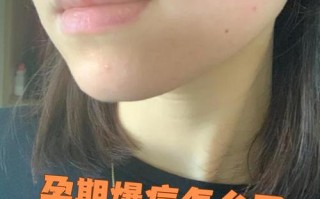 孕期长痘痘是激素变化导致的吗？如何安全应对孕期皮肤问题？