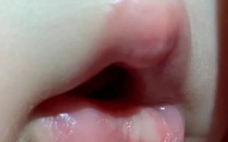 儿童嘴唇发白是贫血还是其他健康问题？需警惕哪些潜在疾病信号？
