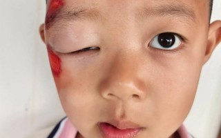 儿童受惊吓后会出现哪些症状？家长该如何判断和应对？