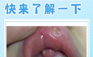 儿童牙龈长肉疙瘩是上火还是病变？需要治疗吗？